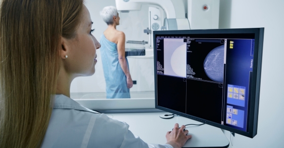 DIGITAL MAMMOGRAM เทคโนโลยี ตรวจหามะเร็งเต้านม