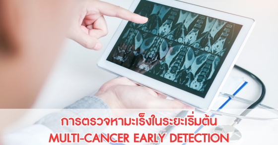 การตรวจหามะเร็งในระยะเริ่มต้น MULTI-CANCER EARLY DETECTION