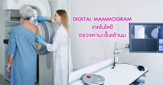 DIGITAL MAMMOGRAM เทคโนโลยี ตรวจหามะเร็งเต้านม